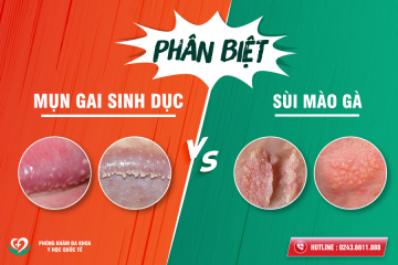 mụn thân dương vật – 3 bệnh nguy hiểm nguy cơ vô sinh – cách chữa hiệu quả không bị lại