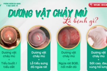 Bệnh Lậu Ở Nam Giới Và Phương Pháp Điều Trị